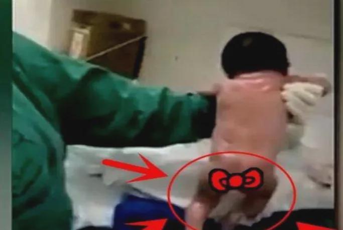  【医学科普】新生儿“撑杆跳”真相：从“最猛宝宝”看原始反射的生理机制与个体差异 健康养生